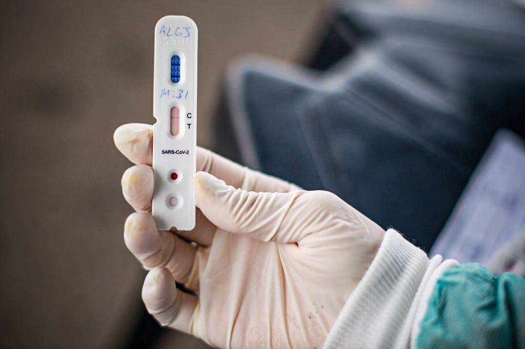 Teste do coronavírus: dados de novos positivos na Europa estão em 25% do pico, quando havia provável subnotificação (Andressa Anholete/Getty Images)